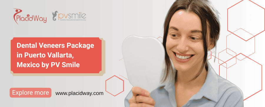 Veneers Puerto Vallarta - Per Tooth at PV Smile