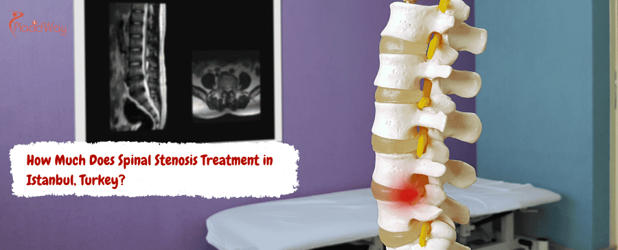 Spinal Stenosis Treatment in Istanbul, Turkey