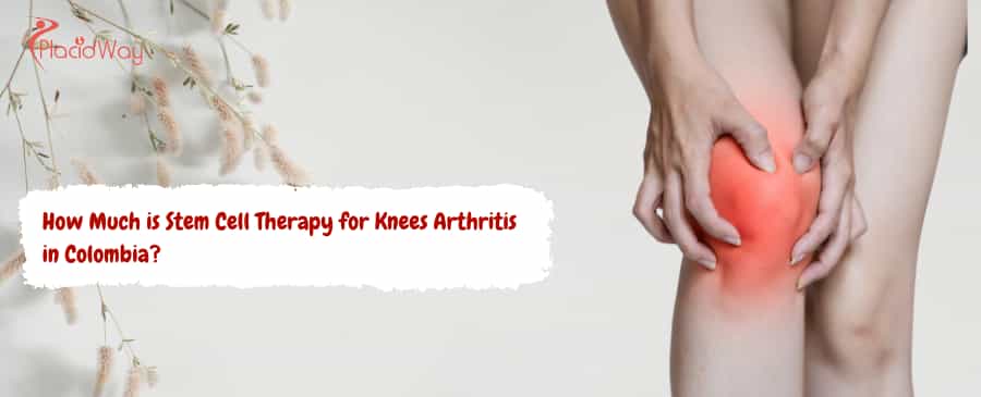 Terapia con células madre para la artritis de rodilla en Colombia