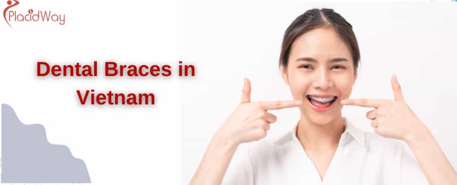 Dental Braces in vietnam