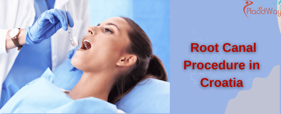 Root Canal Procedure in Croatia