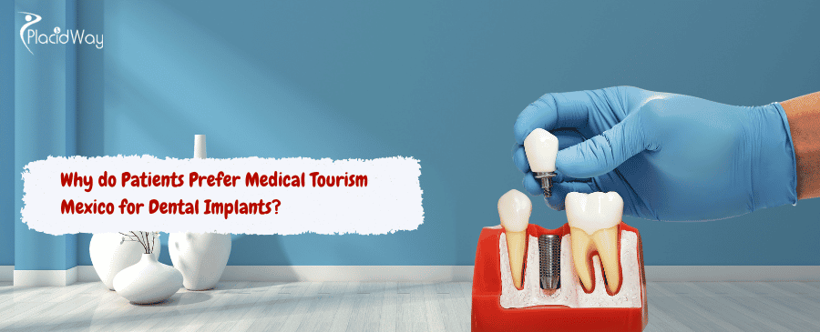 Medical Tourism Mexico for Dental Implants
