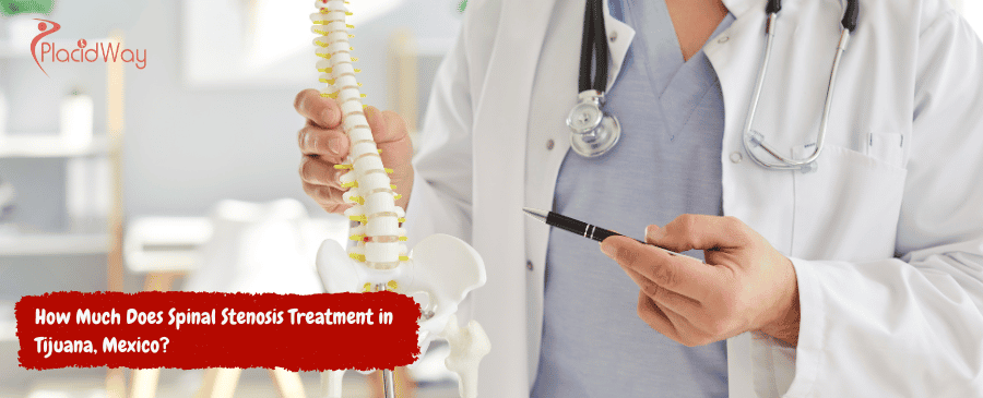 Tratamiento de la estenosis espinal en Tijuana, México