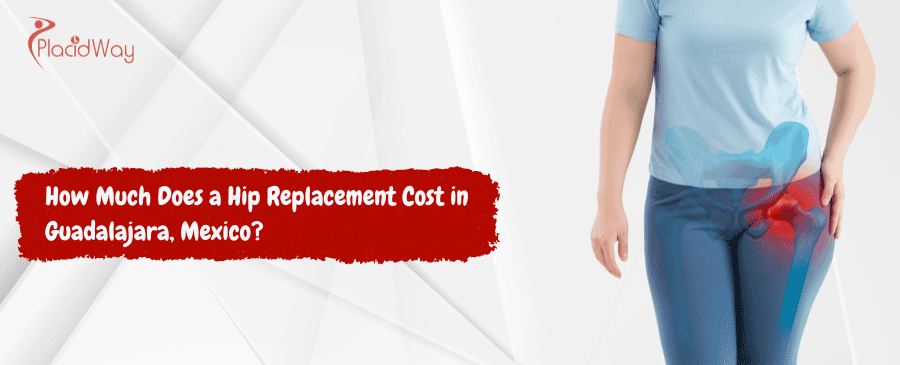 Hip Replacement Cost in Guadalajara, Mexico