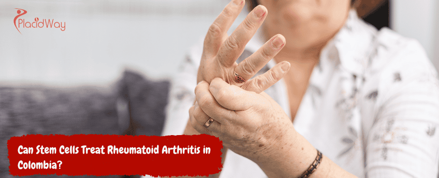 Células madre tratan la artritis reumatoide en Colombia