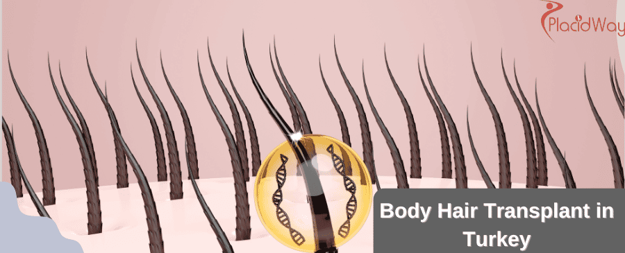 Body Hair Transplant in Turkey