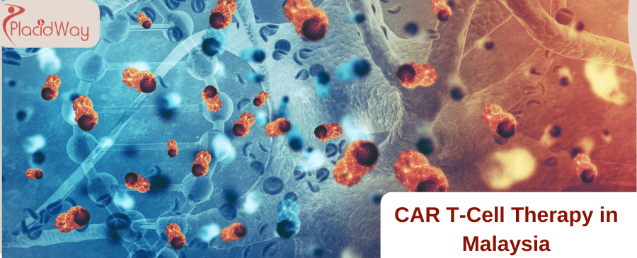 CAR T-Cell Therapy in Malaysia
