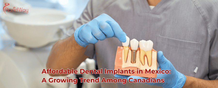dental implants in mexico