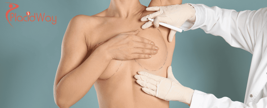 breast augmentation in mexico