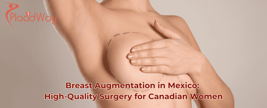 breast augmentation in mexico