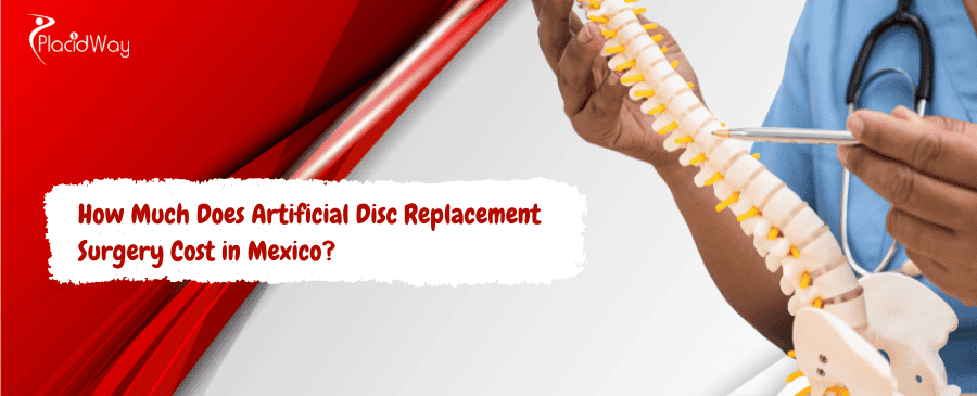  Artificial Disc Replacement Surgery Cost in Mexico