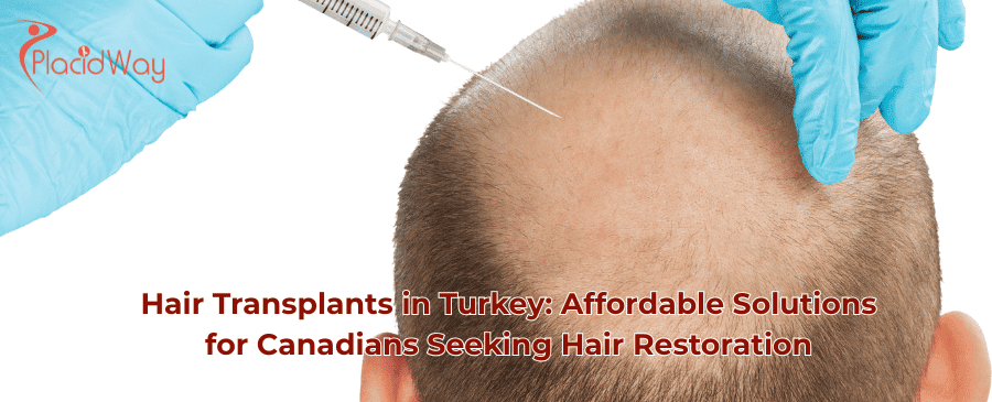 Hair Transplant in Turkey