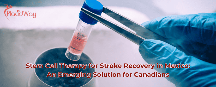 Stem Cell Therapy for Stroke Recovery in Mexico