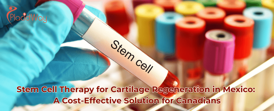 stem cell therapy in Mexico 