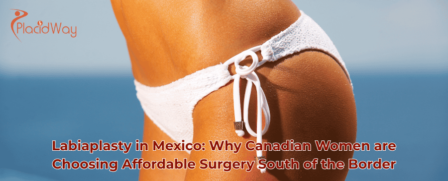 Labiaplasty in Mexico