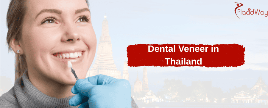 Dental Veneer in Thailand