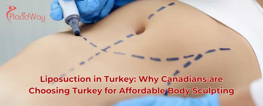 liposuction in Turkey