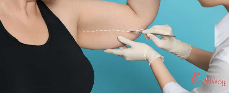 liposuction in Turkey