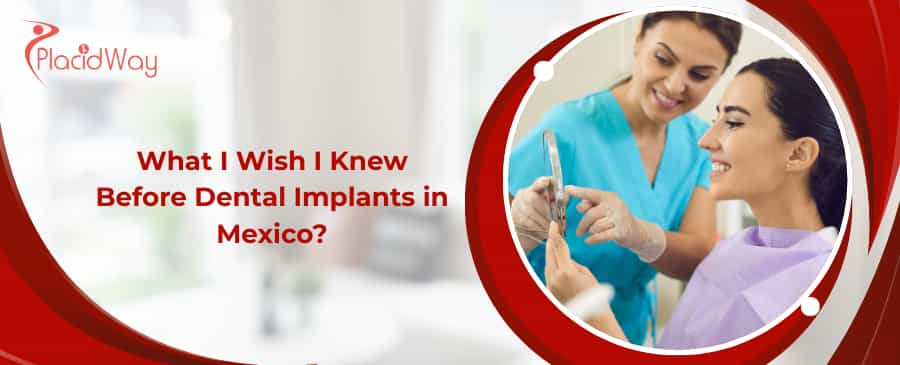 dental implants in Mexico
