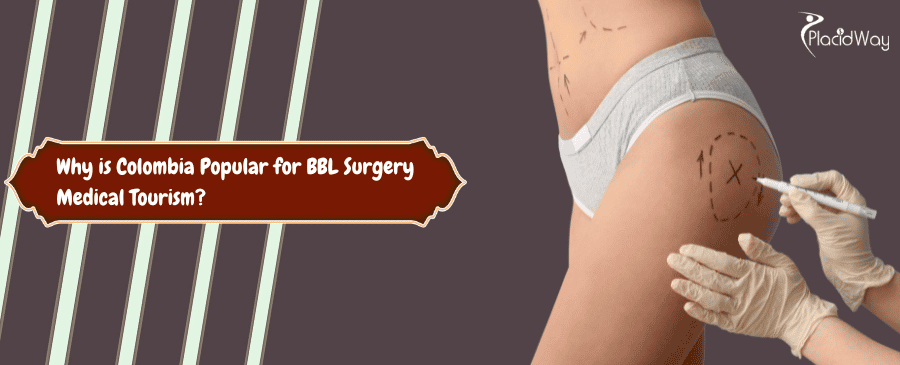 Colombia Popular for BBL Surgery Medical Tourism
