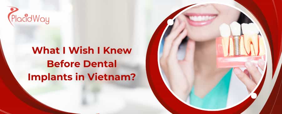 Dental Implants in Vietnam