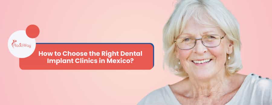How to Choose the Right Dental Implant Clinics in Mexico?