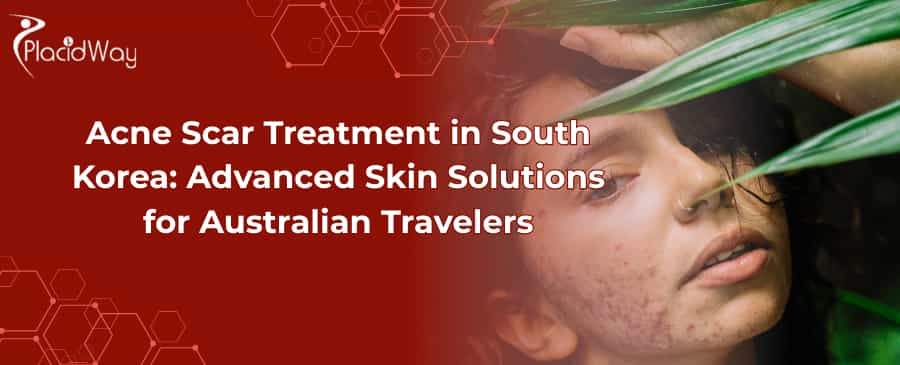 Acne Scar Treatment in South Korea
