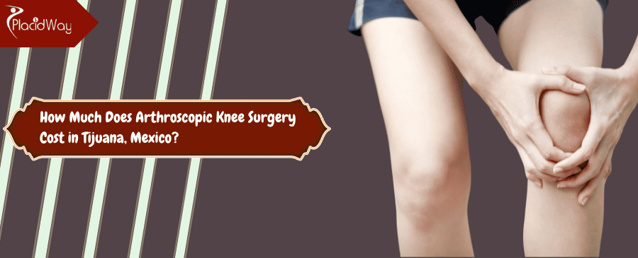 Arthroscopic Knee Surgery Cost in Tijuana, Mexico