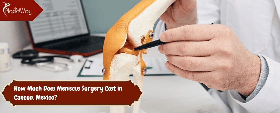 Meniscus Surgery Cost in Cancun, Mexico