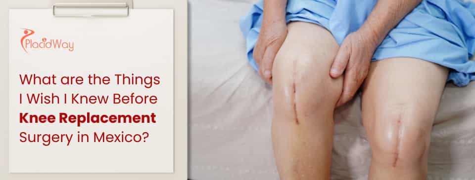 Knee Replacement in Mexico