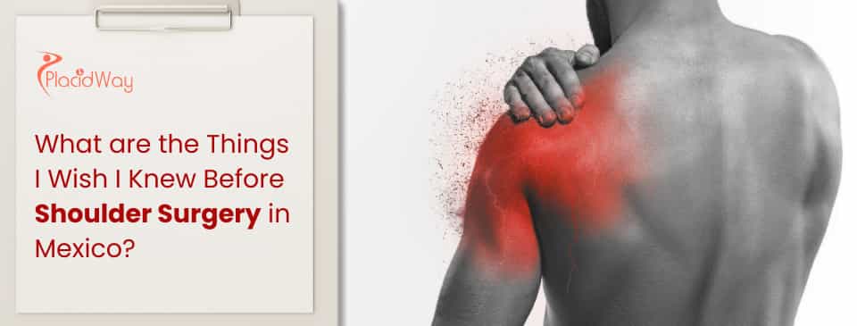 Shoulder Surgery in Mexico