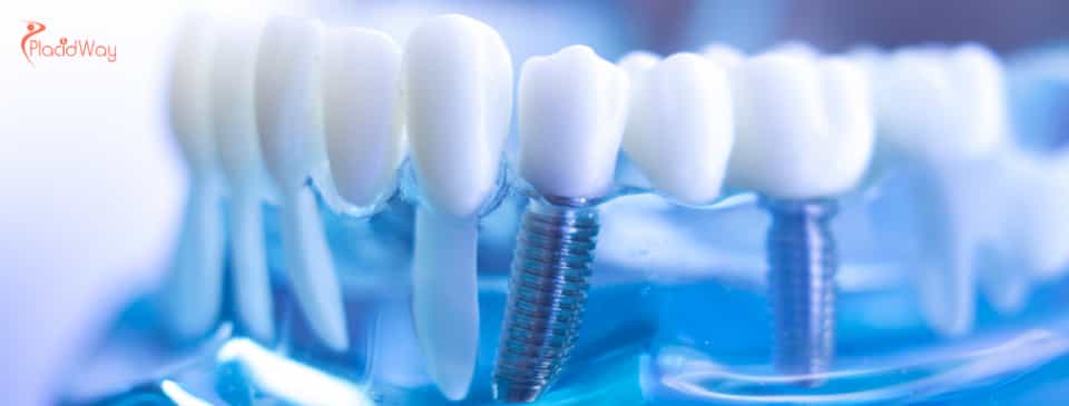 /article/1537/Is-It-Safe-to-Have-Dental-Implants-in-Turkey