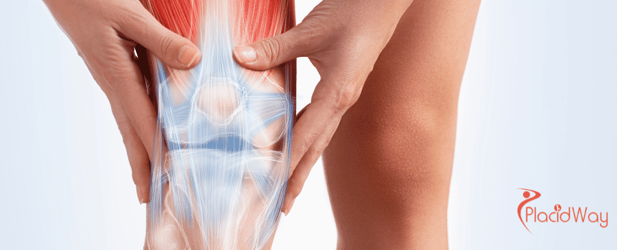 Arthroscopic Knee Surgery in Turkey
