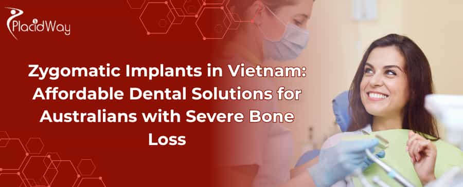 Zygomatic Implants in Vietnam