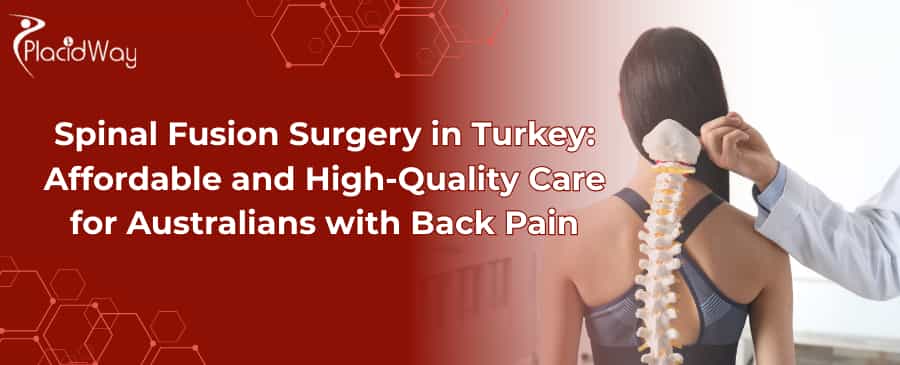 Spinal Fusion Surgery in Turkey