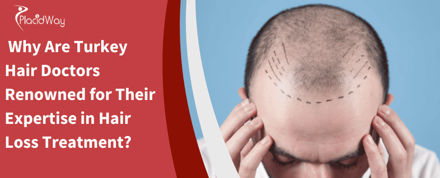 Why Are Turkey Hair Doctors Renowned for Their Expertise in Hair Loss Treatment