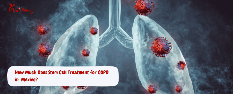 Stem Cell Treatment for COPD in Mexico