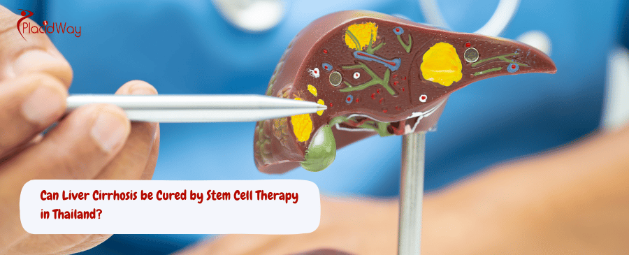 Liver Cirrhosis by Stem Cell Therapy in Thailand