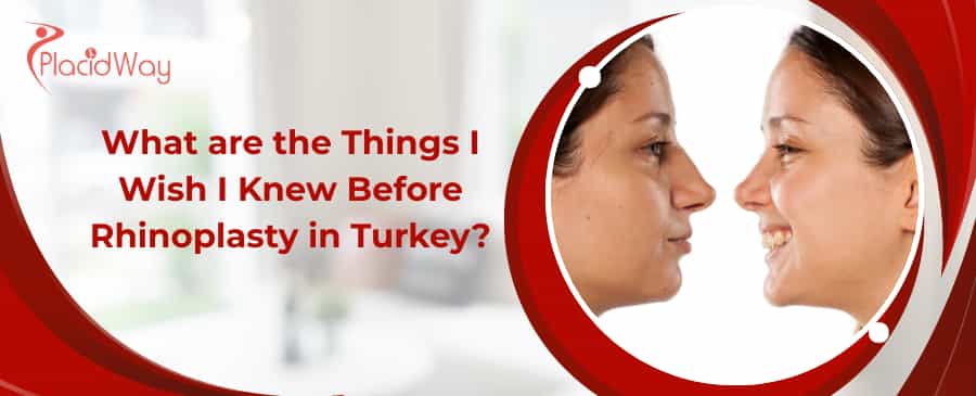 rhinoplasty in Turkey