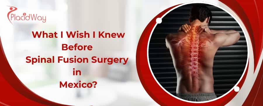 Spinal Fusion in Mexico