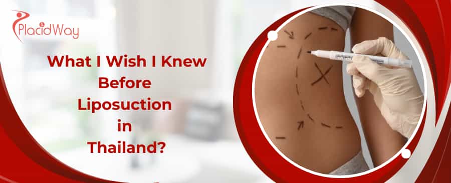 Liposuction in Thailand