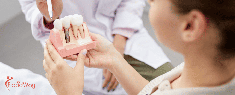 dental implants in Turkey