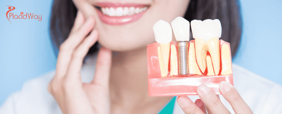 dental implants in Turkey