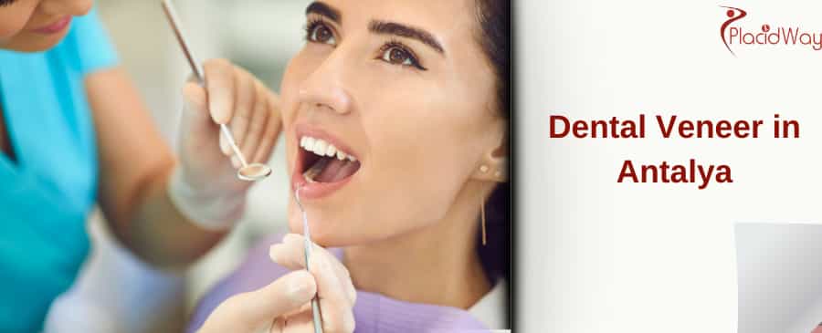 Dental Veneer in Antalya