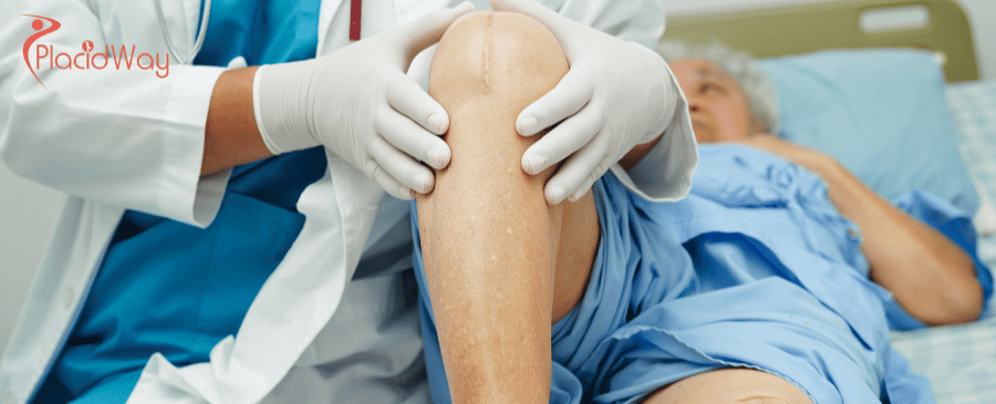 Total Knee Replacement in Turkey