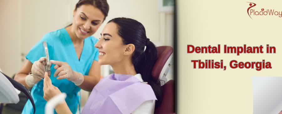 Dental Implant in Tbilisi, Georgia