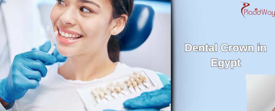 Dental Crown in Egypt