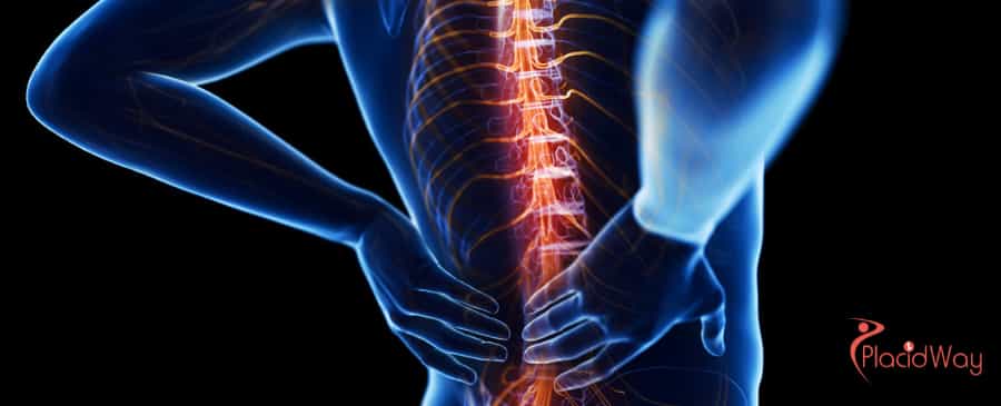 SCI Stem Cell Therapy in Colombia