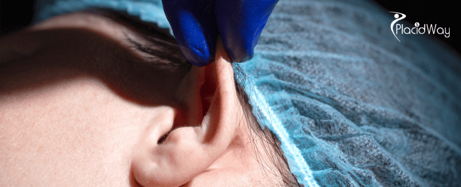 Otoplasty in Turkey