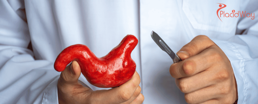 Gastric Sleeve Surgery in Turkey